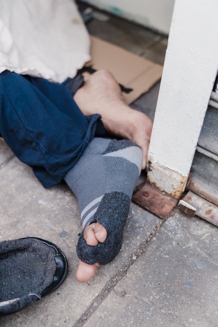 close up of a foot of a homeless person
